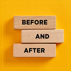 Before & After Gallery at Seacoast Rejuvenation Center in Newington NH