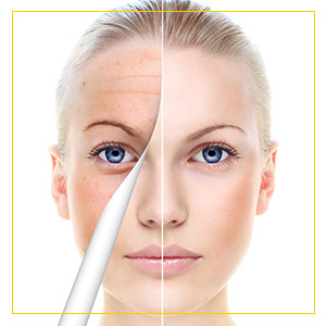 Chemical Peels Treatment Specialist Near Me in Newington NH