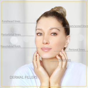 Dermal Filler Post Care Instructions by Seacoast Rejuvenations Center in Newington NH