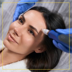 Microneedling With PRP Post Care Instructions by Seacoast Rejuvenation Center in Newington NH