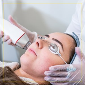 RF Microneedling Post Care Instructions by Seacoast Rejuvenation Center in Newington NH
