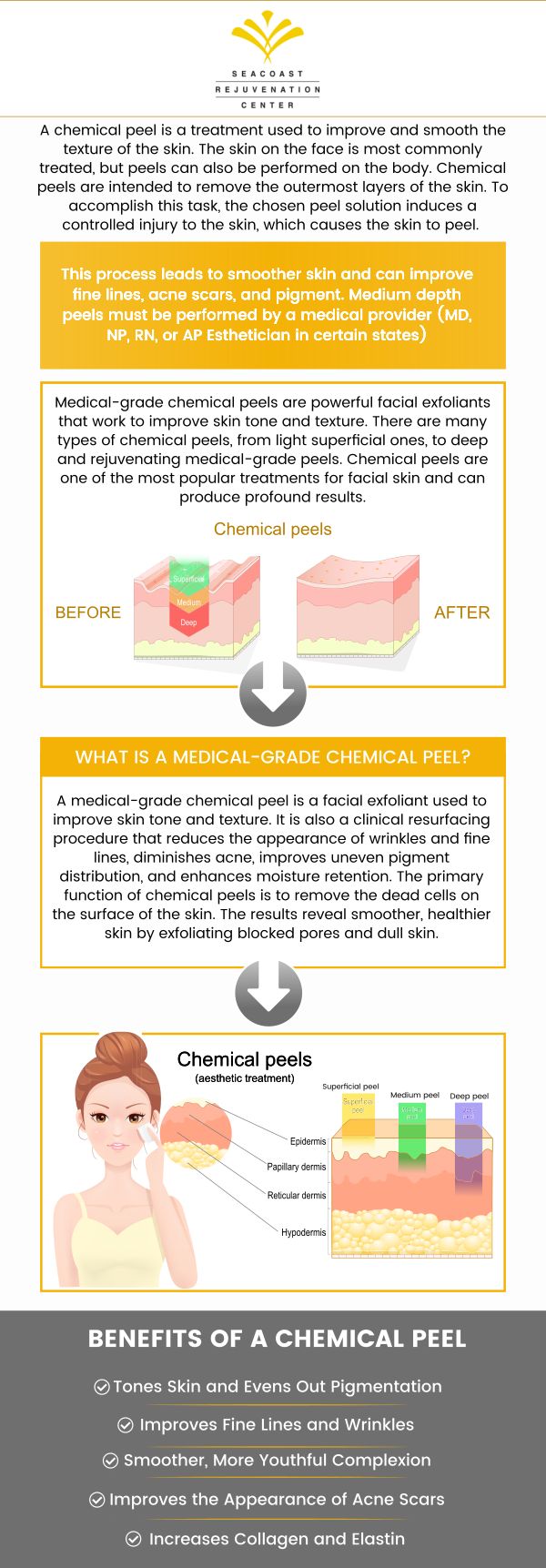 If you want to enhance and smooth your skin without surgical intervention, a chemical peel may be the right treatment for you! Visit Seacoast Rejuvenation Center today to learn the benefits of chemical peels. Contact us today or book an appointment online. Our med spa is conveniently located at 101 Shattuck Way Suite #1 Newington, NH 03801. If you want to enhance and smooth your skin without surgical intervention, a chemical peel may be the right treatment for you! Visit Seacoast Rejuvenation Center today to learn the benefits of chemical peels. Contact us today or book an appointment online. Our med spa is conveniently located at 101 Shattuck Way Suite #1 Newington, NH 03801.