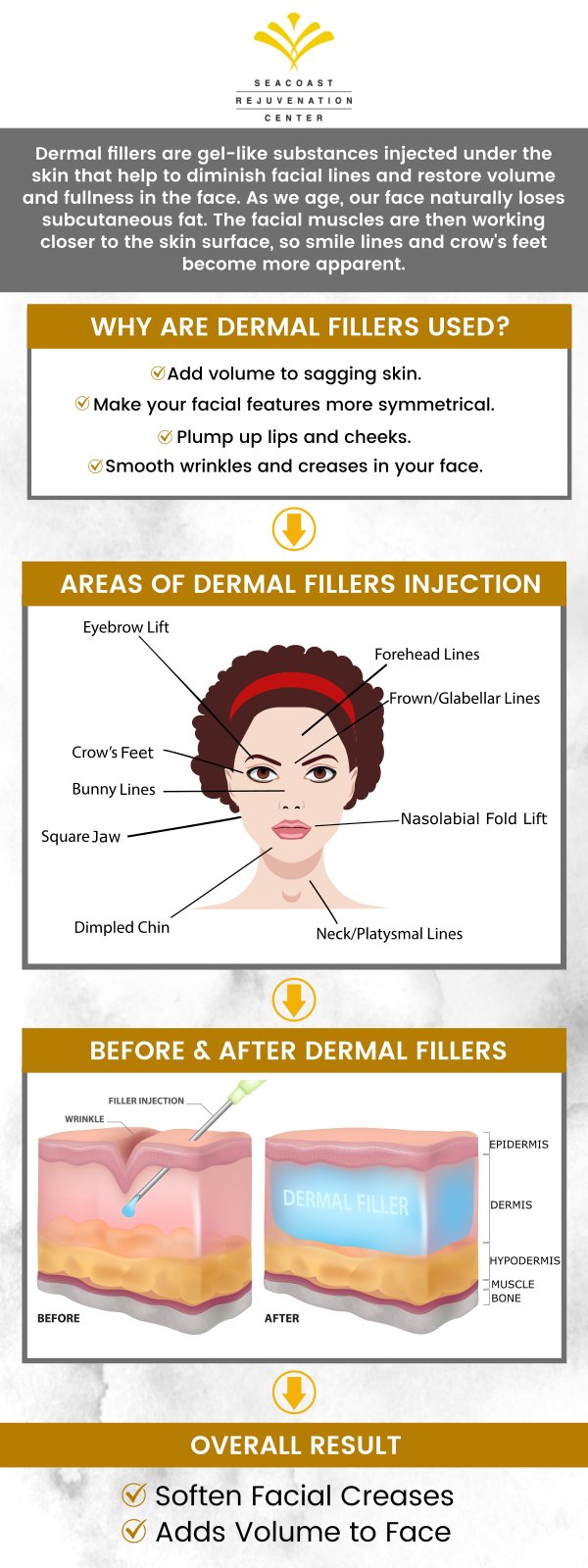 Dermal fillers are soft gel-like substances that work by creating skin replacements that may have been lost due to the appearance of wrinkles. Dermal Filler injections take only a few minutes and they make a big difference. Visit Seacoast Rejuvenation Center for more information. Contact us today or schedule an appointment online. Our med spa is conveniently located at 101 Shattuck Way Suite #1 Newington, NH 03801. Dermal fillers are soft gel-like substances that work by creating skin replacements that may have been lost due to the appearance of wrinkles. Dermal Filler injections take only a few minutes and they make a big difference. Visit Seacoast Rejuvenation Center for more information. Contact us today or schedule an appointment online. Our med spa is conveniently located at 101 Shattuck Way Suite #1 Newington, NH 03801.