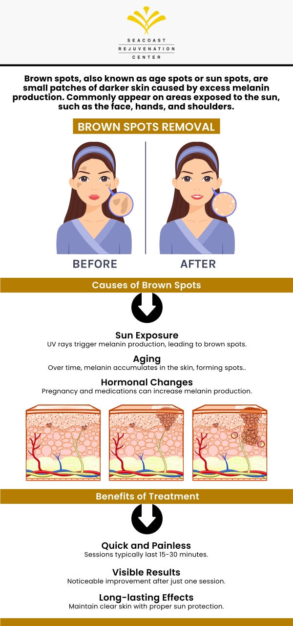 At Seacoast Rejuvenation Center we offer various treatment options for the removal of brown spots. We are open 5 days a week for your convenience. For more information, contact us or schedule an appointment online. Our med spa is conveniently located at 101 Shattuck Way Suite #1 Newington, NH 03801. At Seacoast Rejuvenation Center we offer various treatment options for the removal of brown spots. We are open 5 days a week for your convenience. For more information, contact us or schedule an appointment online. Our med spa is conveniently located at 101 Shattuck Way Suite #1 Newington, NH 03801.