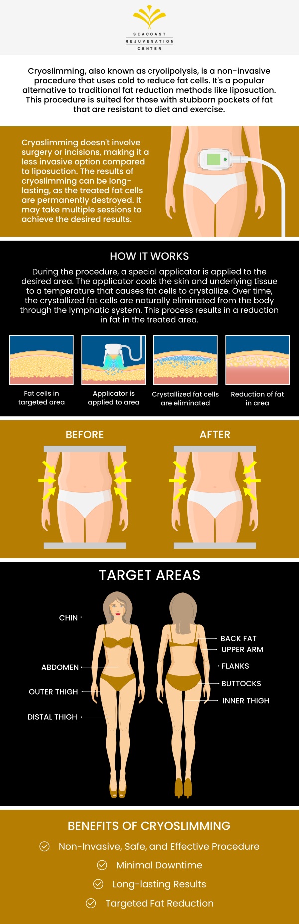 Cryoslimming at Seacoast Rejuvenation Center in Newington, NH, is an innovative treatment designed to target and reduce stubborn fat pockets without surgery. The cost of Cryoslimming greatly depends on the treatment area and the number of sessions required to achieve your desired results. Our expert team led by Dr. Keenan Al-Hojerry will provide a personalized treatment plan for your unique needs. Experience the benefits of Cryoslimming and achieve a slimmer, more contoured physique. Contact us today to schedule your consultation and learn more about our competitive pricing options. Our med spa is conveniently located at 101 Shattuck Way Suite #1 Newington, NH 03801. Cryoslimming at Seacoast Rejuvenation Center in Newington, NH, is an innovative treatment designed to target and reduce stubborn fat pockets without surgery. The cost of Cryoslimming greatly depends on the treatment area and the number of sessions required to achieve your desired results. Our expert team led by Dr. Keenan Al-Hojerry will provide a personalized treatment plan for your unique needs. Experience the benefits of Cryoslimming and achieve a slimmer, more contoured physique. Contact us today to schedule your consultation and learn more about our competitive pricing options. Our med spa is conveniently located at 101 Shattuck Way Suite #1 Newington, NH 03801.