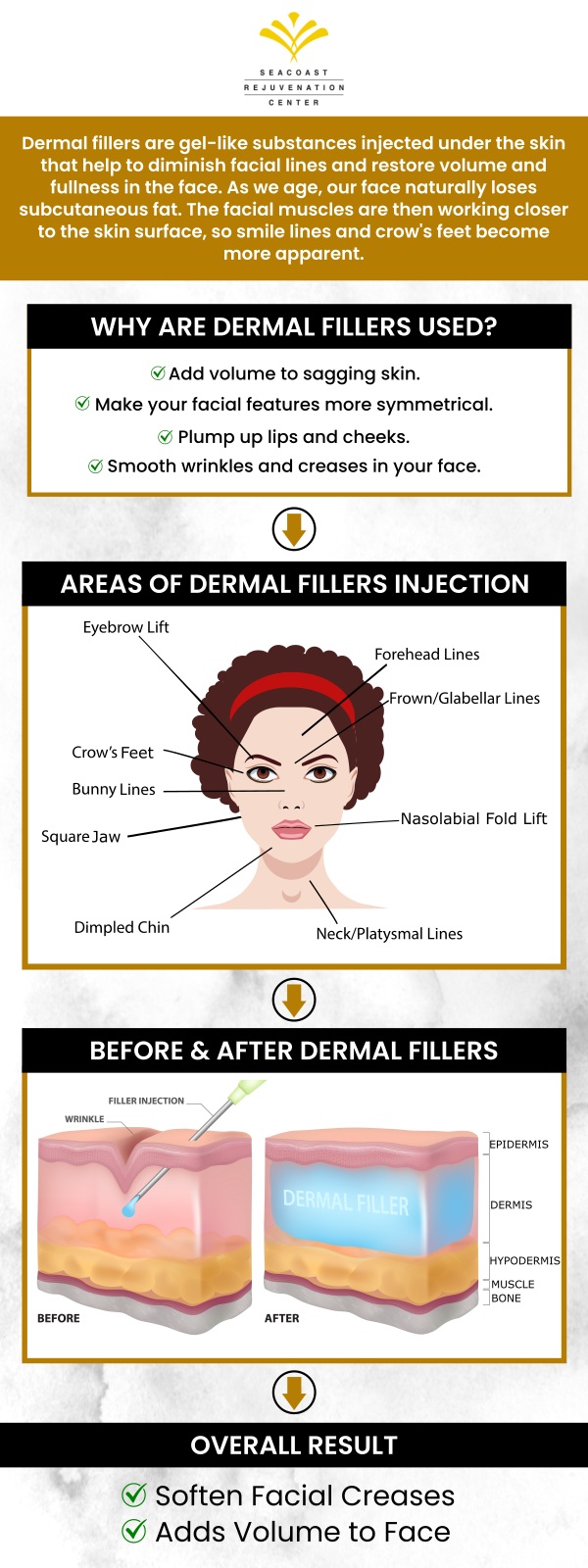fillers help to diminish facial lines and restore volume and fullness in the face. Visit Seacoast Rejuvenation today to learn the benefits of the different fillers we offered. For more information, contact us or schedule an appointment online. Our med spa is conveniently located at 101 Shattuck Way Suite #1 Newington, NH 03801. fillers help to diminish facial lines and restore volume and fullness in the face. Visit Seacoast Rejuvenation today to learn the benefits of the different fillers we offered. For more information, contact us or schedule an appointment online. Our med spa is conveniently located at 101 Shattuck Way Suite #1 Newington, NH 03801.