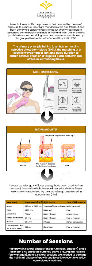 Laser hair removal works by using pulsed light created by a laser system to destroy the hair follicle. This stops hair growth at the source and keeps your underarms and legs super smooth. Get ready for summer at Seacoast Rejuvenation Center! Contact us today for more information or schedule an appointment online. Our med spa is conveniently located at 101 Shattuck Way Suite #1 Newington, NH 03801. Laser hair removal works by using pulsed light created by a laser system to destroy the hair follicle. This stops hair growth at the source and keeps your underarms and legs super smooth. Get ready for summer at Seacoast Rejuvenation Center! Contact us today for more information or schedule an appointment online. Our med spa is conveniently located at 101 Shattuck Way Suite #1 Newington, NH 03801.