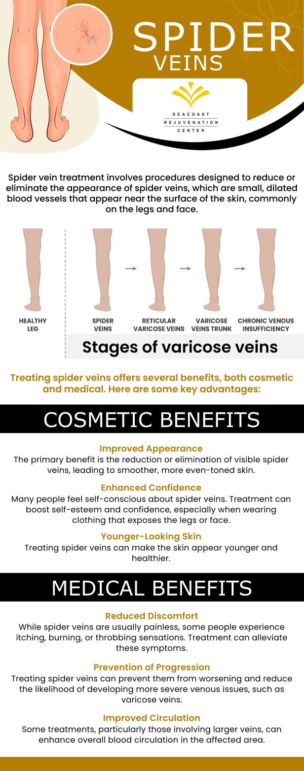 Discover effective Spider Vein Treatment at Seacoast Rejuvenation Center in Newington, NH. Our advanced procedures reduce the appearance of unsightly spider veins, restoring your skin's natural beauty. Enjoy the confidence of smoother, clearer skin with our safe and minimally invasive treatments tailored to your needs. For more information, contact us today or schedule an appointment online. Our med spa is conveniently located at 101 Shattuck Way Suite #1 Newington, NH 03801. Discover effective Spider Vein Treatment at Seacoast Rejuvenation Center in Newington, NH. Our advanced procedures reduce the appearance of unsightly spider veins, restoring your skin's natural beauty. Enjoy the confidence of smoother, clearer skin with our safe and minimally invasive treatments tailored to your needs. For more information, contact us today or schedule an appointment online. Our med spa is conveniently located at 101 Shattuck Way Suite #1 Newington, NH 03801.