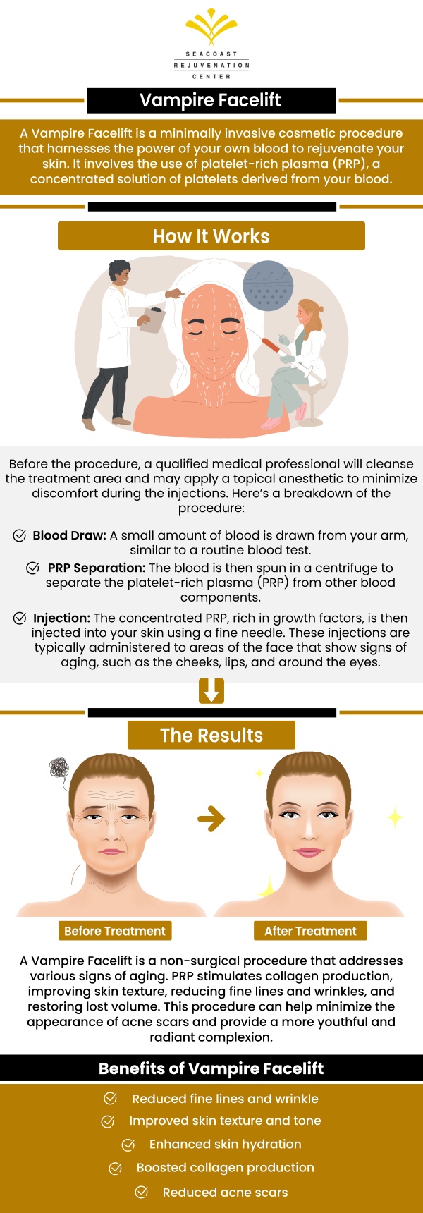 Lifts the lines of your face, restores the fullness of youth, and brightens skin tone with vampire facelift treatment at Seacoast Rejuvenation Center. For more information, contact us or schedule an appointment online. Our med spa is conveniently located at 101 Shattuck Way Suite #1 Newington, NH 03801. Lifts the lines of your face, restores the fullness of youth, and brightens skin tone with vampire facelift treatment at Seacoast Rejuvenation Center. For more information, contact us or schedule an appointment online. Our med spa is conveniently located at 101 Shattuck Way Suite #1 Newington, NH 03801.